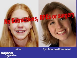 Initial   1yr 3mo posttreatment
 