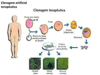 Clonagem artificial
terapêutica
 
