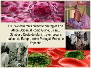 O HIV-2 está mais presente em regiões da
África Ocidental, como Guiné, Bissau,
Gâmbia e Costa do Marfim, e em alguns
países da Europa, como Portugal, França e
Espanha
 