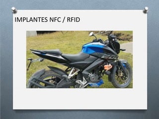 Biohacking (Implantes NFC/RFID) | PPTX