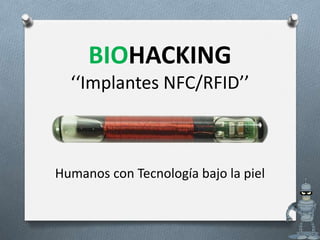 BIOHACKING
‘‘Implantes NFC/RFID’’
Humanos con Tecnología bajo la piel
 