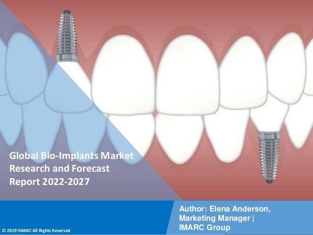Copyright © IMARC Service Pvt Ltd. All Rights Reserved
Global Bio-Implants Market
Research and Forecast
Report 2022-2027
Author: Elena Anderson,
Marketing Manager |
IMARC Group
© 2019 IMARC All Rights Reserved
 