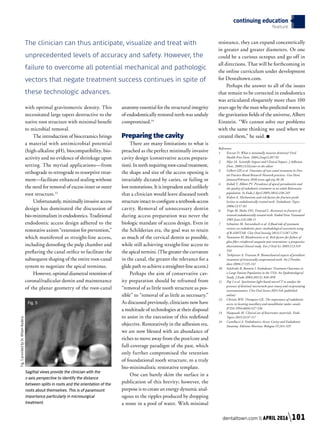 with optimal gravitometric density. This
necessitated large tapers destructive to the
native root structure with minimal benefit
to microbial removal.
The introduction of bioceramics brings
a material with antimicrobial potential
(high-alkaline pH), biocompatibility, bio-
activity and no evidence of shrinkage upon
setting. The myriad applications—from
orthograde to retrograde to resorptive treat-
ment—facilitate enhanced sealing without
the need for removal of excess inner or outer
root structure.13
Unfortunately, minimally invasive access
design has dominated the discussion of
bio-minimalism in endodontics. Traditional
endodontic access design adhered to the
restorative axiom “extension for prevention,”
which manifested as straight-line access,
including deroofing the pulp chamber and
preflaring the canal orifice to facilitate the
subsequent shaping of the entire root-canal
system to negotiate the apical terminus.
However, optimal diametral retention of
coronal/radicular dentin and maintenance
of the planar geometry of the root-canal
anatomy essential for the structural integrity
of endodontically restored teeth was unduly
compromised.14
Preparing the cavity
There are many limitations to what is
preached as the perfect minimally invasive
cavity design (conservative access prepara-
tion). In teeth requiring root-canal treatment,
the shape and size of the access opening is
invariably dictated by caries, or failing or
lost restorations. It is imprudent and unlikely
that a clinician would leave diseased tooth
structureintacttoconfigureatextbook-access
cavity. Removal of unnecessary dentin
during access preparation was never the
biologic mandate of access design. Even in
the Schilderian era, the goal was to retain
as much of the cervical dentin as possible,
while still achieving straight-line access to
the apical termini. (The greater the curvature
in the canal, the greater the relevance for a
glide path to achieve a straighter-line access.)
Perhaps the aim of conservative cav-
ity preparation should be reframed from
“removal of as little tooth structure as pos-
sible” to “removal of as little as necessary.”
As discussed previously, clinicians now have
a multitude of technologies at their disposal
to assist in the execution of this redefined
objective. Restoratively in the adhesion era,
we are now blessed with an abundance of
riches to move away from the post/core and
full-coverage paradigm of the past, which
only further compromised the retention
of foundational tooth structure, to a truly
bio-minimalistic restorative template.
One can barely skim the surface in a
publication of this brevity; however, the
purpose is to create an energy dynamic anal-
ogous to the ripples produced by dropping
a stone in a pool of water. With minimal
resistance, they can expand concentrically
in greater and greater diameters. Or one
could be a curious octopus and go off in
all directions. That will be forthcoming in
the online curriculum under development
for Dentaltown.com.
Perhaps the answer to all of the issues
that remain to be corrected in endodontics
was articulated eloquently more than 100
years ago by the man who predicted waves in
the gravitation fields of the universe, Albert
Einstein. “We cannot solve our problems
with the same thinking we used when we
created them,” he said. ■
References
1.	 Ericson D. What is minimally invasive dentistry? Oral
Health Prev Dent. 2004;2(sup1):287-92
2.	 Mjor IA. Scientific Impact and Clinical Impact. J Adhesion
Dent. 2009;11(3)Letter to the editor
3. 	 Gilbert GH et al. Outcomes of root canal treatment in Den-
tal Practice-Based Research Network practices. Gen Dent;
January/February 2010 www.agd.org 28-36
4.	 Kabak Y, Abbott PV. Prevalence of apical periodontitis and
the quality of endodontic treatment in an adult Belarusian
population. In Endo J April 2005;38(4):238-245
5.	 Kishen A. Mechanisms and risk factors for fracture predi-
lection in endodontically treated teeth. Endodontic Topics
2006;13:57-83
6.	 Trope M, Maltz DO, Tronstad L. Resistance to fracture of
restored endodontically treated teeth. Endod Dent Traumatol
1985 June;1(3):108-11
7.	 Schmitter M, Sterzenbach et al. A flood tide of systematic
reviews on endodontic posts: methodological assessment using
of R-AMSTAR. Clin Oral Investig 2013;17:1287-1294
8.	 Naumann M, Blankenstein et al. Risk factors for failure of
glass fiber-reinforced composite post restorations: a prospective
observational clinical study. Eur J Oral Sci 2005;113:519-
524
9.	 Torbjorner A. Fransson B. Biomechanical aspects of prosthetic
treatment of structurally compromised teeth. Int J Prostho-
dont 2004;17:135-141
10.	 Salehrabi R, Rotstein I. Endodontic Treatment Outcomes in
a Large Patient Population in the USA: An Epidemiological
Study. J Endo 2004;30(12): 846-850
11.	 Pop I et al. Synchroton light-based microCT to analyse the
presence of dentinal microcracks post-rotary and reciprocating
instrumentation. Clin Oral Invest 2014 Feb (published
online)
12.	 Christie WH, Thompson GK. The importance of endodontic
access in locating maxillary and mandibular molar canals.
JCDA 1994;60(6):527-536
13.	 Haapasalo M. Clinical use of bioceramic materials. Endo
Topics 2015;32:97-117
14.	 Castellucci A. Endodontics; Access Cavity and Endodontic
Anatomy. Editions Martina, Bologna IT;244-329
Fig. 5
Sagittal views provide the clinician with the
z-axis perspective to identify the distance
between splits in roots and the orientation of the
roots about themselves. This is of paramount
importance particularly in microsurgical
treatment.
The clinician can thus anticipate, visualize and treat with
unprecedented levels of accuracy and safety. However, the
failure to overcome all potential mechanical and pathologic
vectors that negate treatment success continues in spite of
these technologic advances.
Fig.5providedbyDr.WiliamNudera
dentaltown.com  APRIL 2016 101
continuing education
feature
 