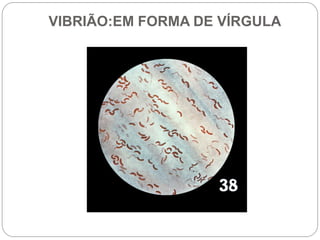 VIBRIÃO:EM FORMA DE VÍRGULA
 