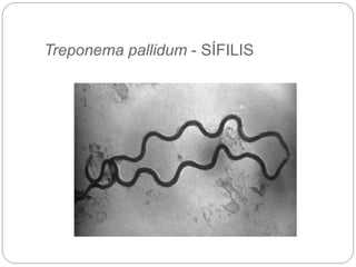 Treponema pallidum - SÍFILIS
 