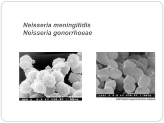 Neisseria meningitidis
Neisseria gonorrhoeae
 