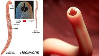 Hookworm
 
