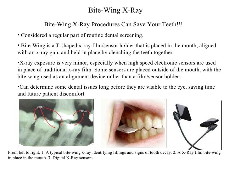 Biology 120 Chapter 8 Digestion