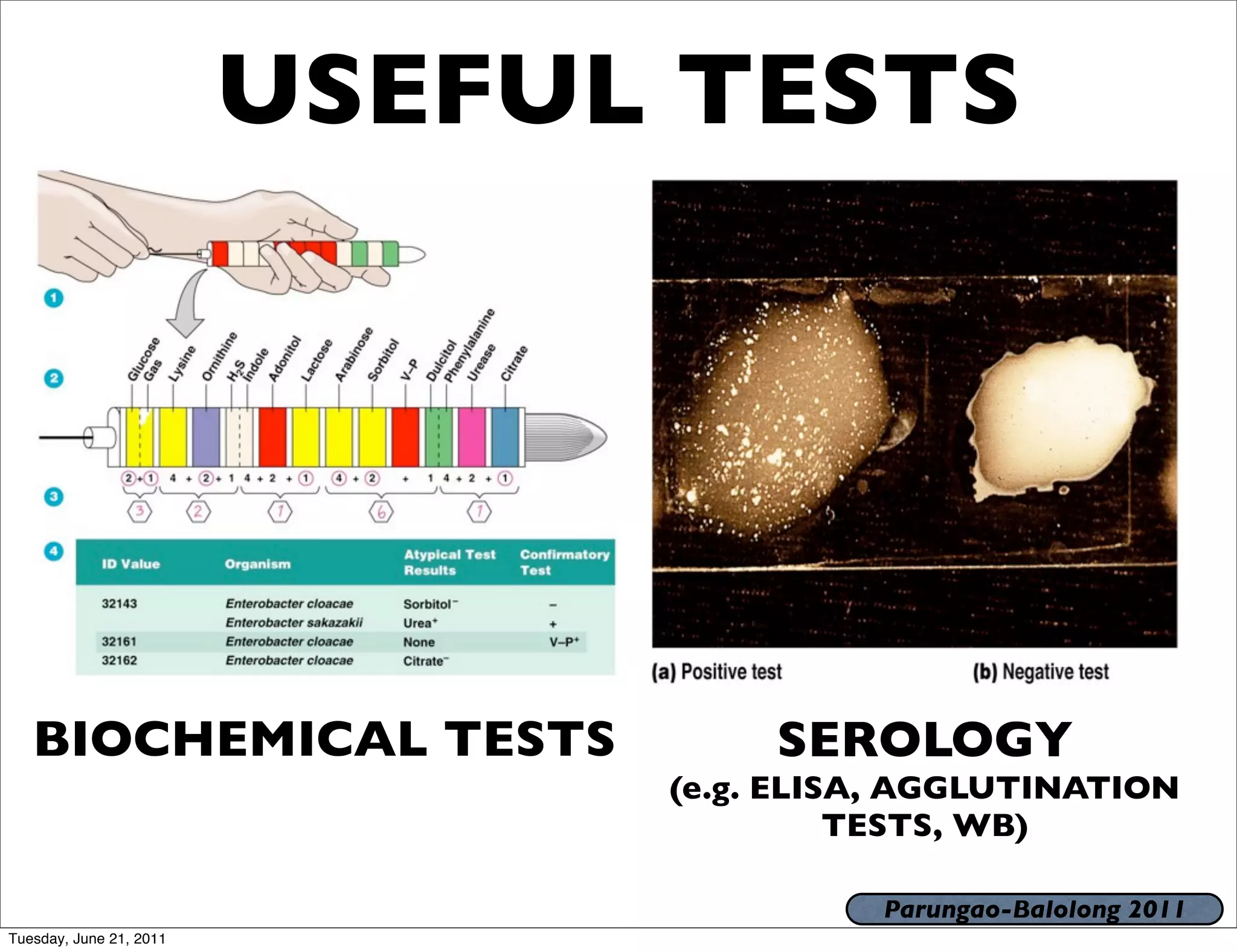 USEFUL TESTS




   BIOCHEMICAL TESTS                SEROLOGY
                               (e.g. ELISA, AGGLUTINATION
                                         TESTS, WB)

                                         Parungao-Balolong 2011
Tuesday, June 21, 2011
 