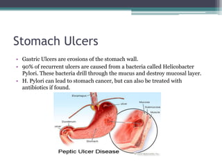 Stomach Ulcers
• Gastric Ulcers are erosions of the stomach wall.
• 90% of recurrent ulcers are caused from a bacteria called Helicobacter
Pylori. These bacteria drill through the mucus and destroy mucosal layer.
• H. Pylori can lead to stomach cancer, but can also be treated with
antibiotics if found.
 