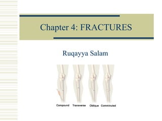 Chapter 4: FRACTURES Ruqayya Salam 