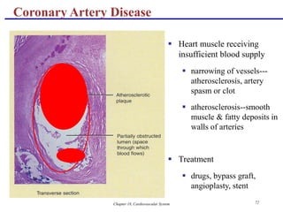 Chapter 18, Cardiovascular System 72
Coronary Artery Disease
 Heart muscle receiving
insufficient blood supply
 narrowing of vessels---
atherosclerosis, artery
spasm or clot
 atherosclerosis--smooth
muscle & fatty deposits in
walls of arteries
 Treatment
 drugs, bypass graft,
angioplasty, stent
 