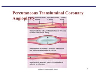 Chapter 18, Cardiovascular System 75
Percutaneous Transluminal Coronary
Angioplasty
 