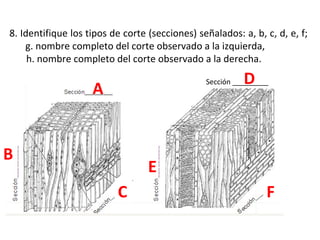 8. Identifique los tipos de corte (secciones) señalados: a, b, c, d, e, f;
g. nombre completo del corte observado a la izquierda,
h. nombre completo del corte observado a la derecha.

D

Sección _________

A
B

E
C

F

 
