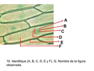 A
B
C
D
E
F

10. Identifique (A, B, C, D, E y F). G. Nombre de la figura
observada.

 