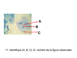 A
B
C

11. Identifique (A, B, C). D. nombre de la figura observada.

 