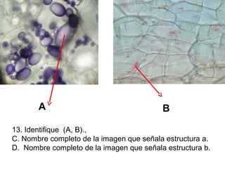 A

B

13. Identifique (A, B).,
C. Nombre completo de la imagen que señala estructura a.
D. Nombre completo de la imagen que señala estructura b.

 