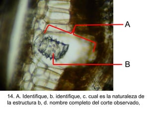 A

B

14. A. Identifique, b. identifique, c. cual es la naturaleza de
la estructura b, d. nombre completo del corte observado,

 