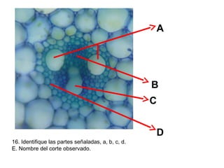 A

B
C
D
16. Identifique las partes señaladas, a, b, c, d.
E. Nombre del corte observado.

 