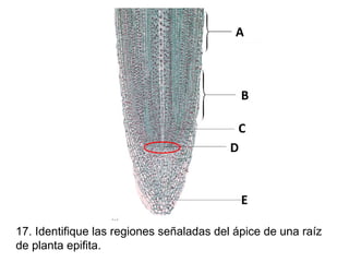 A

B
C
D

E
17. Identifique las regiones señaladas del ápice de una raíz
de planta epifita.

 
