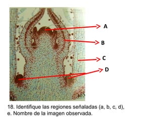 A
B
C
D

18. Identifique las regiones señaladas (a, b, c, d),
e. Nombre de la imagen observada.

 