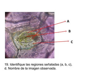 A
B
C

19. Identifique las regiones señaladas (a, b, c),
d. Nombre de la imagen observada.

 