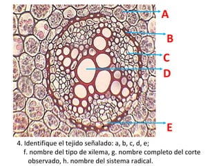 A
B
C
D

E
4. Identifique el tejido señalado: a, b, c, d, e;
f. nombre del tipo de xilema, g. nombre completo del corte
observado, h. nombre del sistema radical.

 