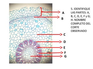 A
B

C
D
E
F
G

5. IDENTIFIQUE
LAS PARTES: A,
B, C, D, E, F y G;
H. NOMBRE
COMPLETO DEL
CORTE
OBSERVADO

 