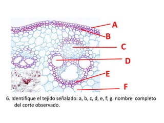 A
B

C
D

E
F
6. Identifique el tejido señalado: a, b, c, d, e, f; g. nombre completo
del corte observado.

 