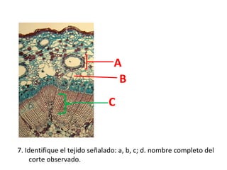 A
B
C

7. Identifique el tejido señalado: a, b, c; d. nombre completo del
corte observado.

 