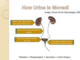 It is Caused by Escherichia coli bacteria which is usually located in the large intestine.