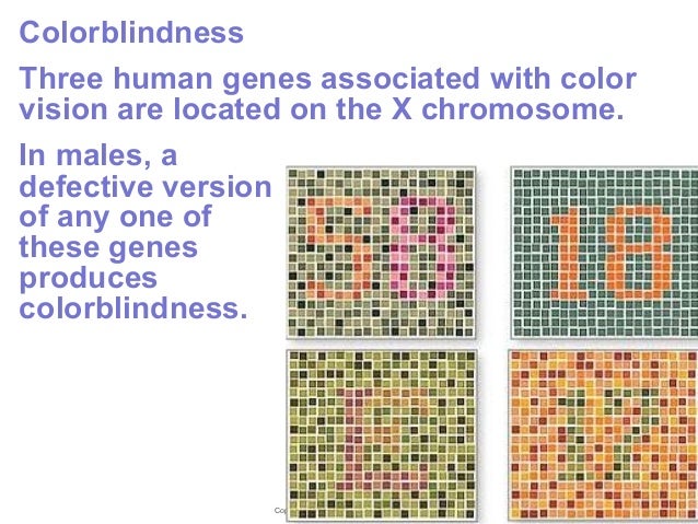 an introduction to duchennes muscular dystrophy as a result of a defective gene on the x chromosome A greater awareness of all rare causes of osteoporosis could reduce the number of an x chromosome treated boys with duchennes muscular dystrophy. an introduction to duchennes muscular dystrophy as a result of a defective gene on the x chromosome A greater awareness of all rare causes of osteoporosis could reduce the number of an x chromosome treated boys with duchennes muscular dystrophy.