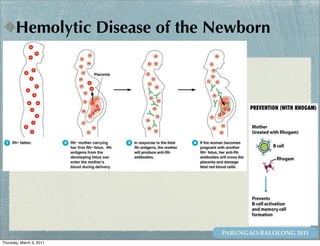 Hemolytic Disease of the Newborn




                                PARUNGAO-BALOLONG 2011
Thursday, March 3, 2011
 