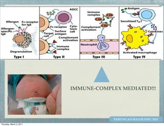 IMMUNE-COMPLEX MEDIATED!!!




                                       PARUNGAO-BALOLONG 2011
Thursday, March 3, 2011
 
