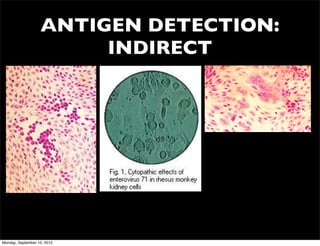 ANTIGEN DETECTION:
                        INDIRECT




Monday, September 10, 2012
 
