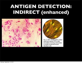 ANTIGEN DETECTION:
                    INDIRECT (enhanced)




Monday, September 10, 2012
 