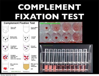 COMPLEMENT
                       FIXATION TEST
                                    http://virology-online.com




                                        path.cam.ac.uk




                 dshs.state.tx.us

Monday, September 10, 2012
 