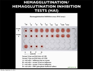HEMAGGLUTINATION/
                    HEMAGGLUTINATION INHIBITION
                            TESTS (HAI)




                               qmark2.leeds.ac.uk   path.cam.ac.uk

Monday, September 10, 2012
 