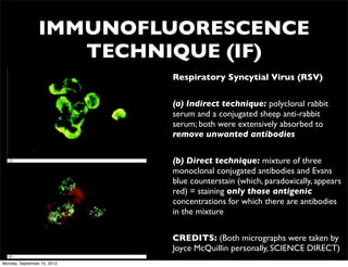 IMMUNOFLUORESCENCE
                    TECHNIQUE (IF)
                             Respiratory Syncytial Virus (RSV)


                             (a) Indirect technique: polyclonal rabbit
                             serum and a conjugated sheep anti-rabbit
                             serum; both were extensively absorbed to
                             remove unwanted antibodies


                             (b) Direct technique: mixture of three
                             monoclonal conjugated antibodies and Evans
                             blue counterstain (which, paradoxically, appears
                             red) = staining only those antigenic
                             concentrations for which there are antibodies
                             in the mixture


                             CREDITS: (Both micrographs were taken by
                             Joyce McQuillin personally, SCIENCE DIRECT)
Monday, September 10, 2012
 