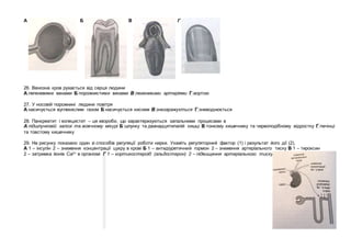 А Б В Г
26. Венозна кров рухається від серця людини
А легеневими венами Б порожнистими венами В легеневими артеріями Г аортою
27. У носовій порожнині людини повітря
А насичується вуглекислим газом Б насичується киснем В знезаражується Г зневоднюється
28. Панкреатит і холецистит – це хвороби, що характеризуються запальними процесами в
А підшлунковій залозі та жовчному міхурі Б шлунку та дванадцятипалій кишці В тонкому кишечнику та червоподібному відростку Г печінці
та товстому кишечнику
29. На рисунку показано один зі способів регуляції роботи нирки. Укажіть регуляторний фактор (1) і результат його дії (2).
А 1 – інсулін 2 – зниження концентрації цукру в крові Б 1 – антидіуретичний гормон 2 – зниження артеріального тиску В 1 – тироксин
2 – затримка йонів Са2+ в організмі Г 1 – кортикостероїд (альдостерон) 2 – підвищення артеріального тиску
 