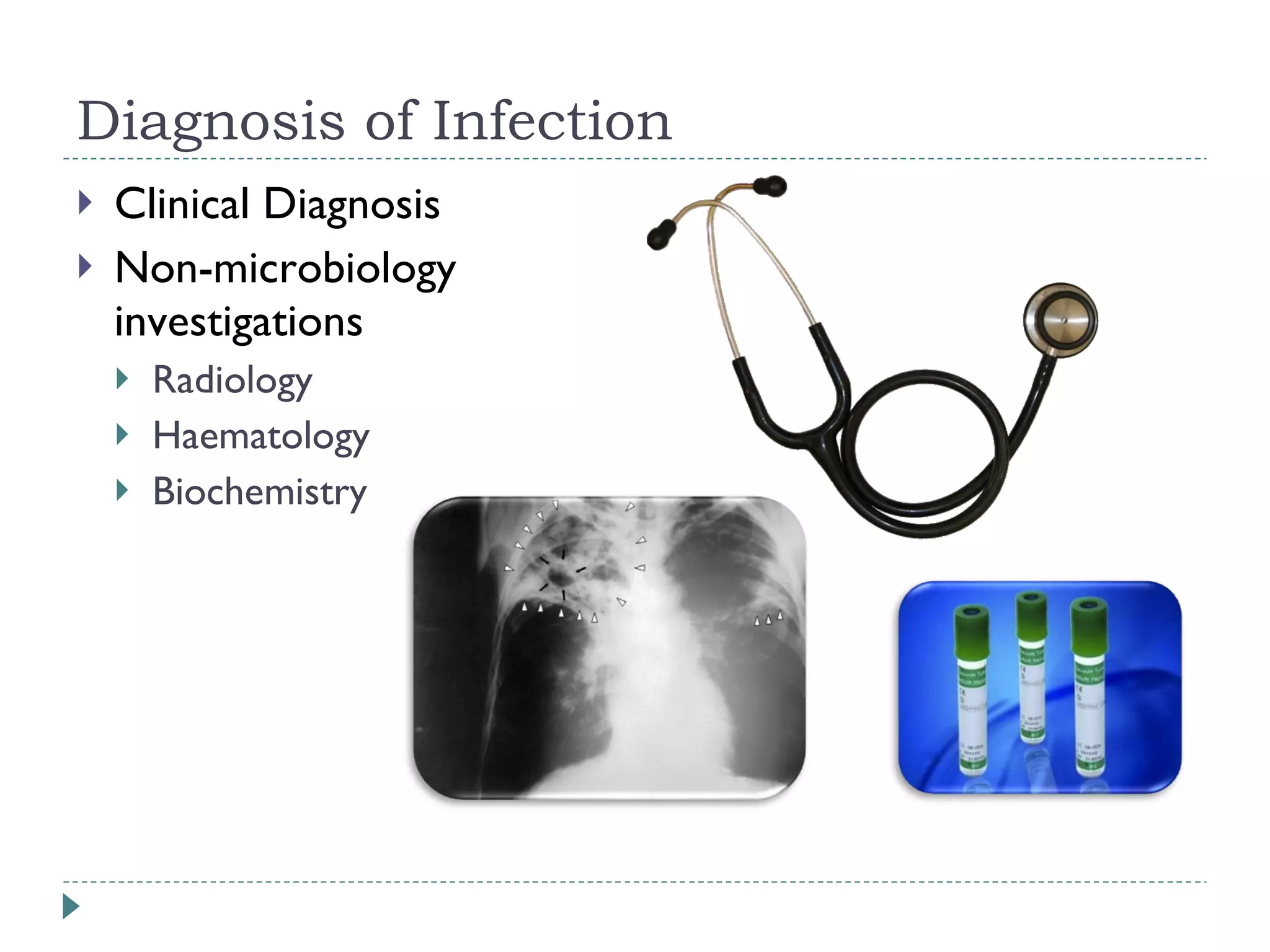 Clinical Diagnosis Non-microbiology investigations Radiology Haematology Biochemistry Diagnosis of Infection 