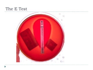 Bio303 laboratory diagnosis of infection | PPT