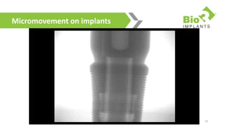 Bio3 Dental Implants Product 2018 Fresh and [Updated] | PPTX