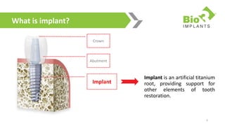 Bio3 Dental Implants Product 2018 Fresh and [Updated] | PPTX