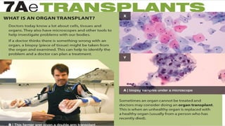 Understanding Life Processes and Human Body Basics for Grade 7 Science