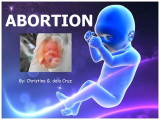 ABORTION By: Christine G. dela Cruz 