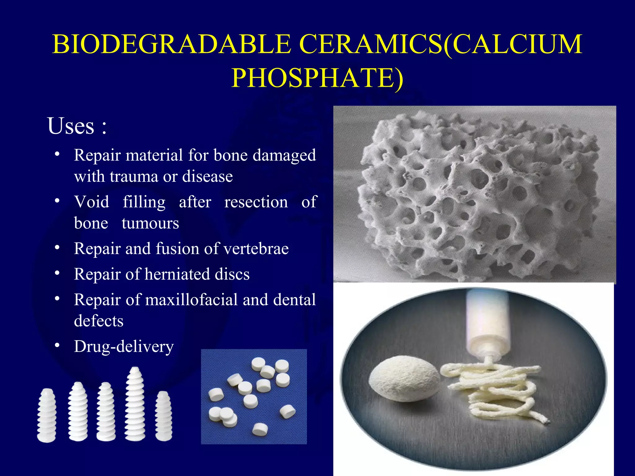 Bioabsorbable Implants in Orthopaedics - Dr Chintan N Patel | PPT