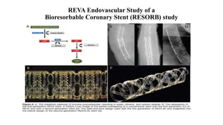 REVA Endovascular Study of a
Bioresorbable Coronary Stent (RESORB) study
 