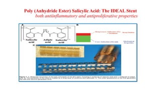 Poly (Anhydride Ester) Salicylic Acid: The IDEAL Stent
both antiinflammatory and antiproliferative properties
 