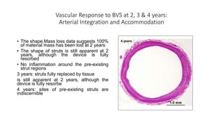 Vascular Response to BVS at 2, 3 & 4 years:
Arterial Integration and Accommodation
4 years
• The shape,Mass loss data suggests 100%
of material mass has been lost at 2 years
• The shape of struts is still apparent at 2
years, although the device is fully
resorbed
• No inflammation around the pre-existing
strut regions
3 years: struts fully replaced by tissue
is still apparent at 2 years, although the
device is fully resorbe
4 years: sites of pre-existing struts are
indiscernible
• No inflammation around the pre-existing
strut regions
 